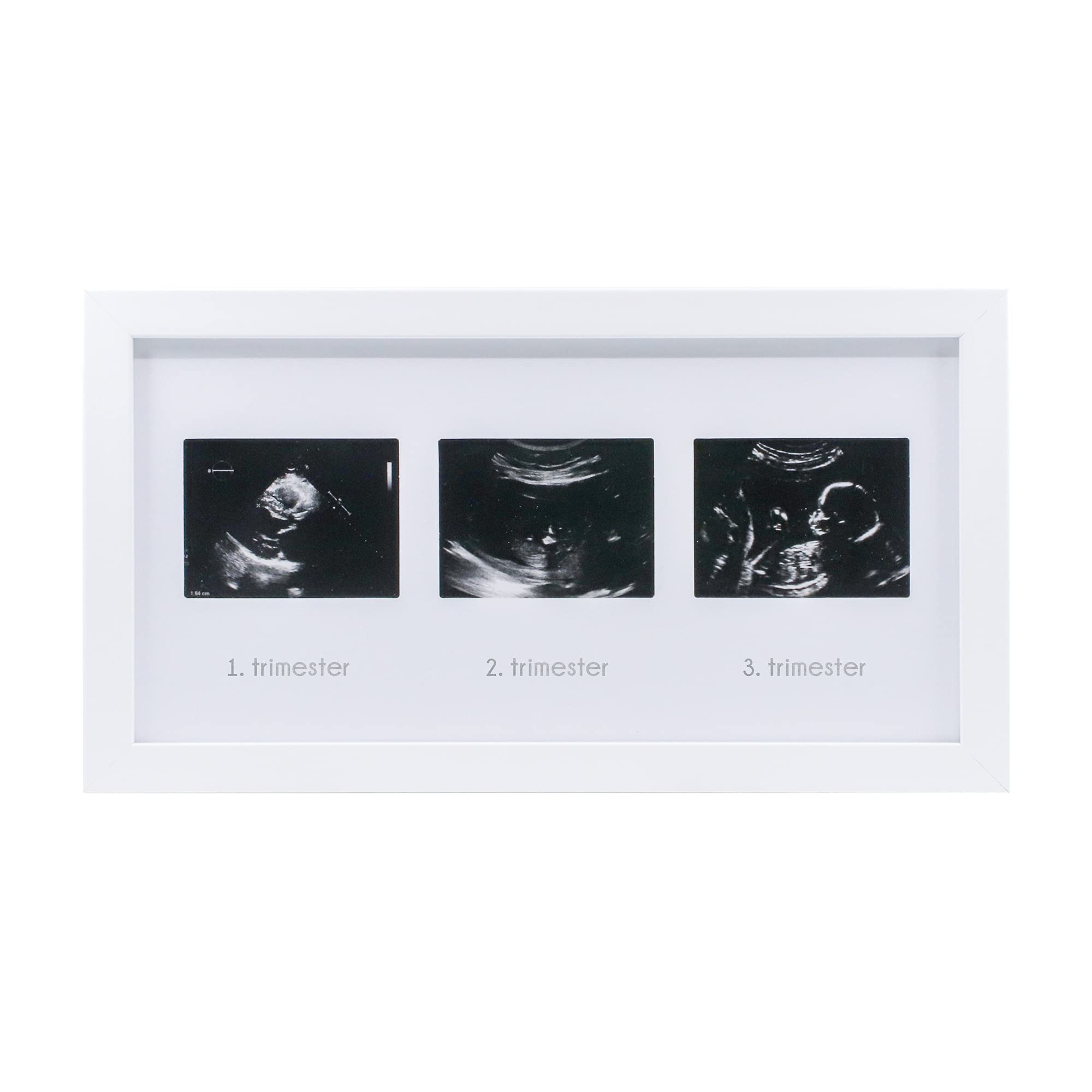 FUFİZU Üçlü Ultrason Anı Çerçevesi - Gebelikte Bebeğin Gelişimini Üç Trimester Anı Olarak Saklayın