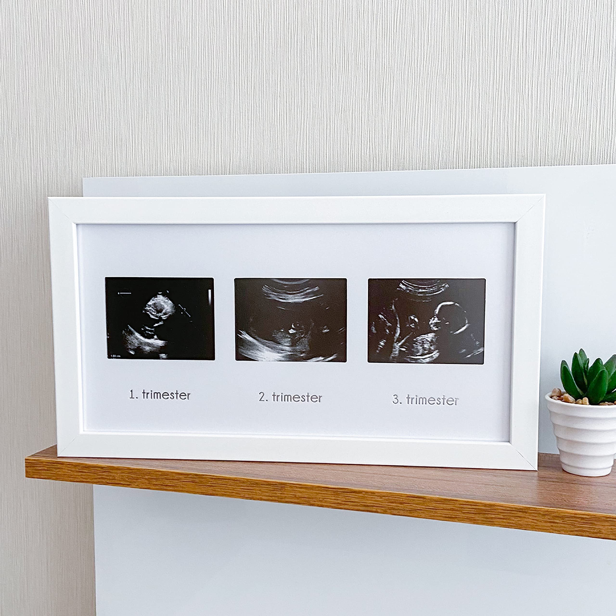 FUFİZU Üçlü Ultrason Anı Çerçevesi - Gebelikte Bebeğin Gelişimini Üç Trimester Anı Olarak Saklayın