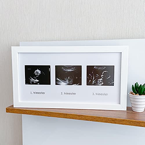 FUFİZU Üçlü Ultrason Anı Çerçevesi - Gebelikte Bebeğin Gelişimini Üç Trimester Anı Olarak Saklayın