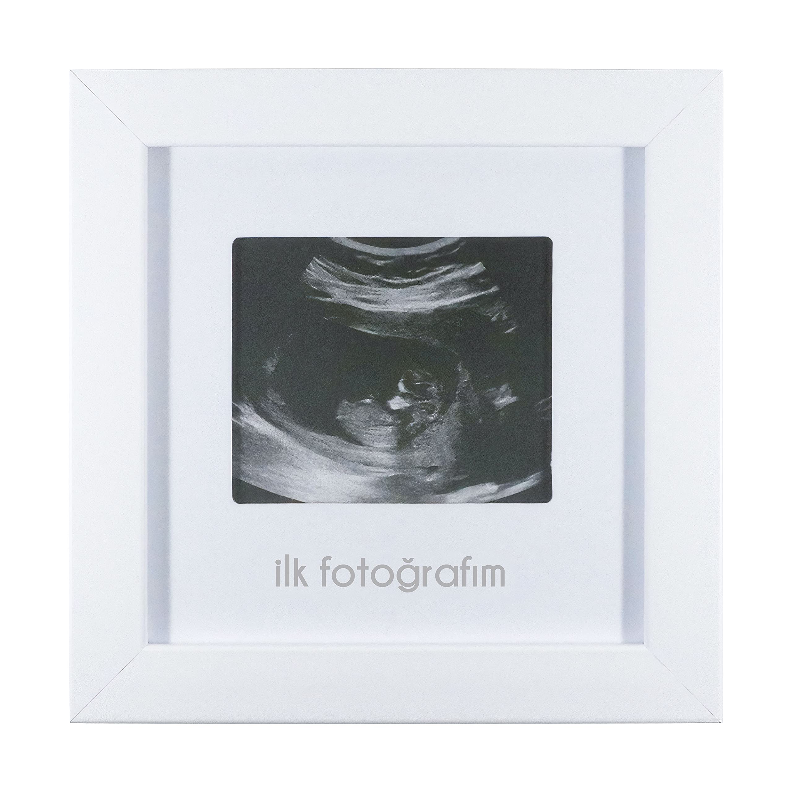 FUFİZU İlk Fotoğrafım Bebek Ultrason Çerçevesi - Bebek Odası Resim Anı Çerçevesi