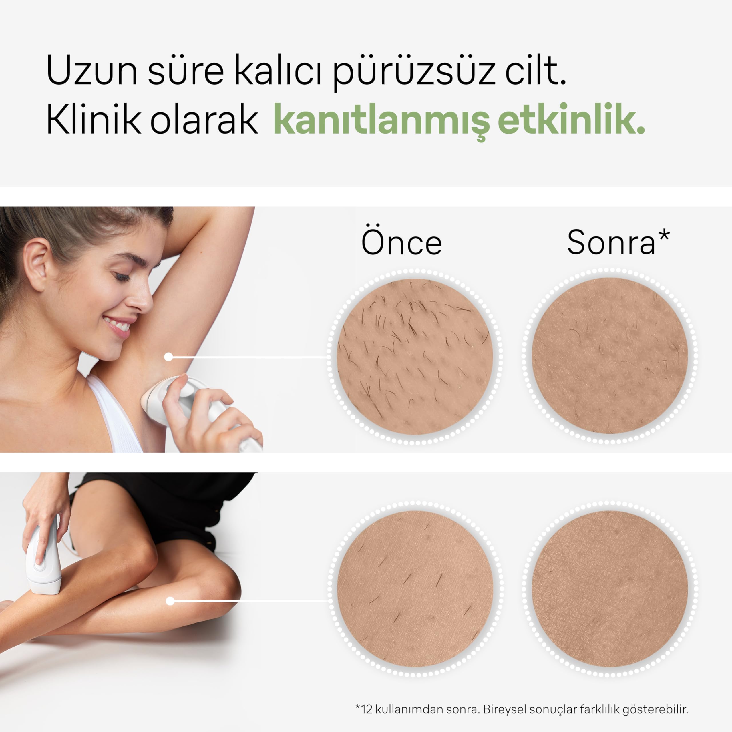 Braun IPL Silk·expert Pro 3, Evde Tüy Alma, Çanta, Venus Tıraş Makinesi, 2 Başlık ile, PL3132