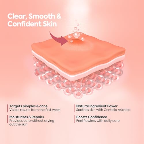 CLASYCARE Akne Kremi Yüz İçin – Sivilce ve Akne Karşıtı Leke Kremi – Salisilik Asit & Niasinamid ile Leke Giderici – Genç ve Yetişkin Cilt Bakımı, 40 ml